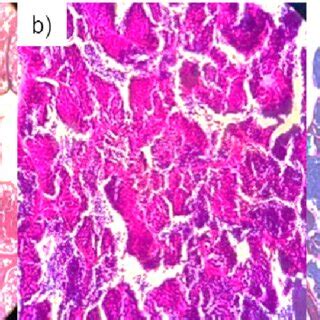 Intersex ZF's gonad histology: TT (testicular tissue); SZ... | Download ...