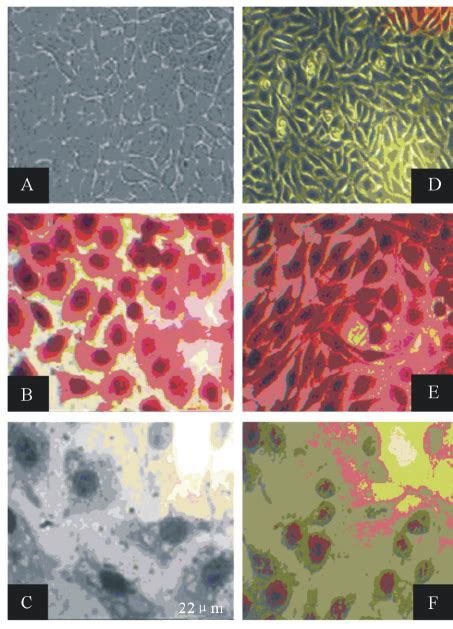 Light microscope image of (A) non stained HeLa cell culture as a ...