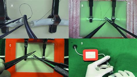 -Vasovasostomy in a training model (A: stitches applied through all... | Download Scientific Diagram