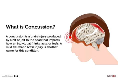 Concussion: Causes, Symptoms, Treatment and Cost