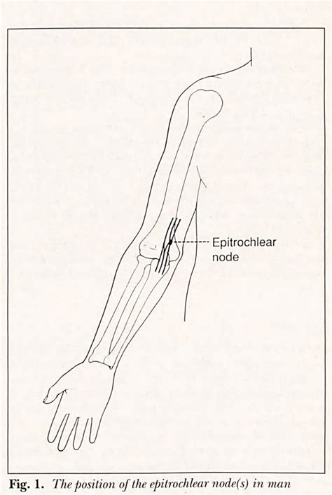 Structure of epitrochlear lymph node | Semantic Scholar