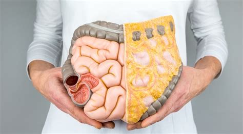 Colon infection: Everything you need to know about it | Health News ...