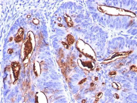 CA19-9/Sialyl Lewisa (GI Tumor Marker) - Clone SPM588 | Not Known