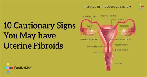 10 Cautionary Signs You May have Uterine Fibroids