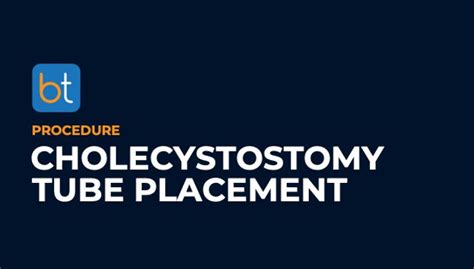 Percutaneous Cholecystostomy Tube Placement Procedure | BackTable VI