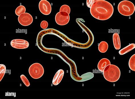 Wuchereria bancrofti. Computer illustration of the microfilaria larval ...