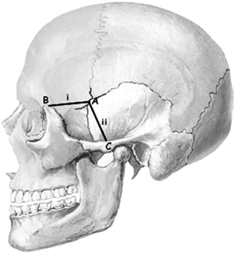 [PDF] Anatomic Position of the Pterion among Kenyans for Lateral Skull Approaches | Semantic Scholar