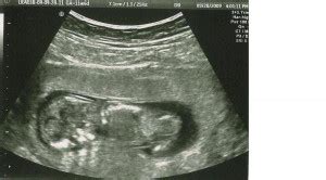 Baby Ultrasound Funny Quotes. QuotesGram