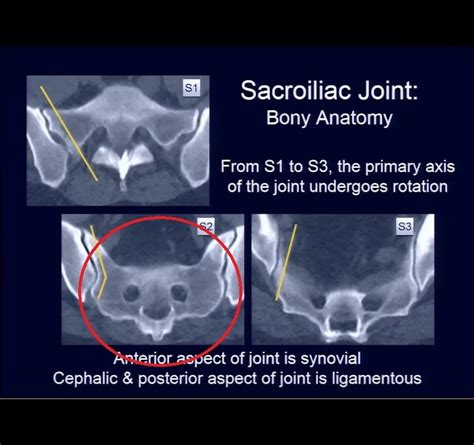 The Sacroiliac Joint: Anatomy, Function and Interventions — OrthopaedicPrinciples.com