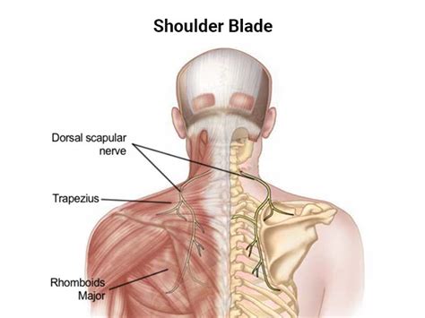 Shoulder Blade Pain: Your Guide to Pain Relief - NJ's Top Orthopedic ...