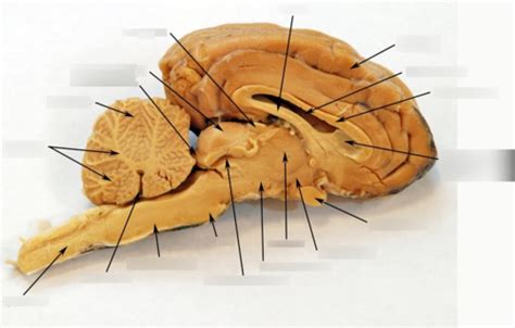 Ventricles Of The Sheep Brain