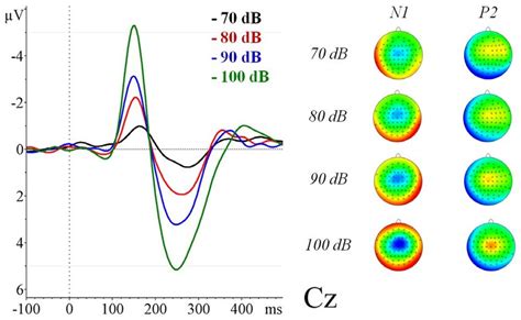 Grand average (n = 16) of the auditory evoked related potentials for... | Download Scientific ...