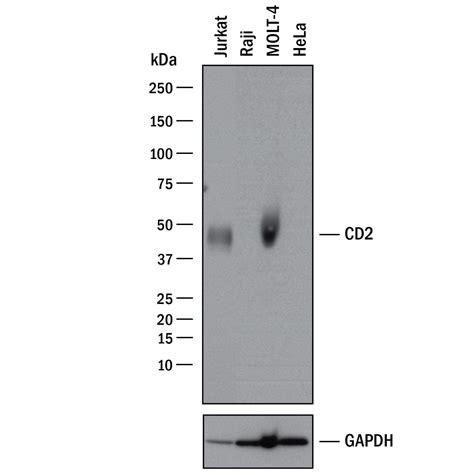 Detection of Human CD2 by Western Blot.