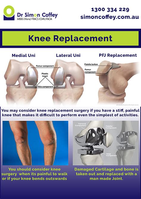 Three Types Of Knee Replacement - Dr.Simon Coffey #KneeReplacement # ...