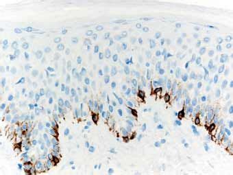 Melanocytes | Medical laboratory science, Histology slides, Anatomy and physiology