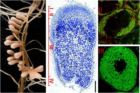 Frontiers | Nitrogen-fixing Rhizobium-legume symbiosis: are polyploidy and host peptide-governed ...