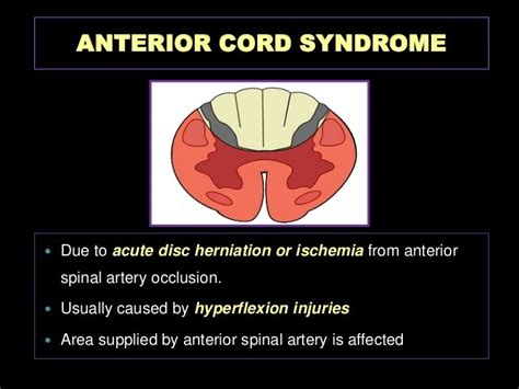 Spinal cord syndromes