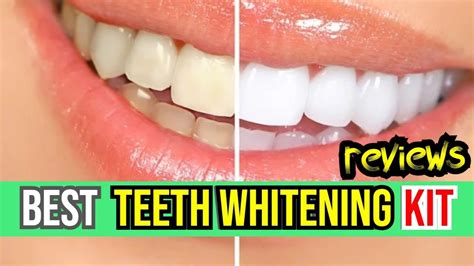 Whiten Your Smile Today! 🦷 iSmile Teeth Whitening Kit Review | Best At-Home Whitening Solutions ...