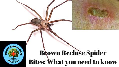 Brown Recluse Bite Identification