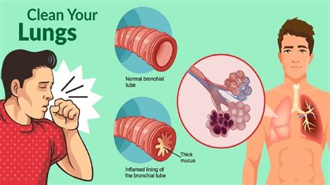 Get Rid of Phlegm and Mucus in Chest & Throat Instantly - Health Cares