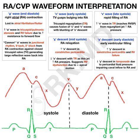 Acv Waves Cvp