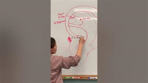 Class 2 Whiteboard Representations of Cavum and Cymba Concha - YouTube