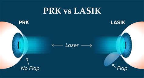 Dos and Don'ts After PRK Laser Surgery