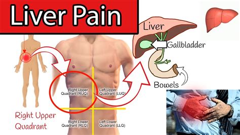 Large Intestine Pain Right Side | Bruin Blog