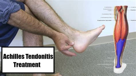 Achilles Tendonitis Treatment - Heel Pain Stretches and Exercises - YouTube