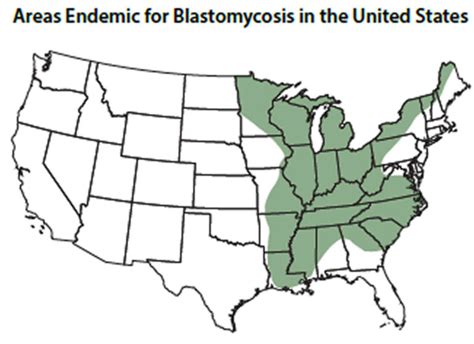 Blastomycosis in humans causes, symptoms, diagnosis and treatment