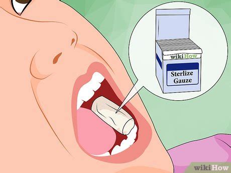 How To Control Wisdom Teeth Pain - Teeth Poster