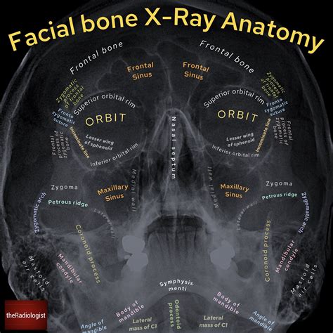 Pin on Radiography