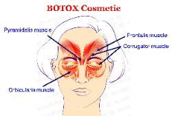 Advanced Medical Aesthetics - Rome, Italy - Botox Treatments