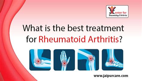 What is the best treatment for rheumatoid arthritis?