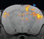 optogenetics-brain-study - BMED Report