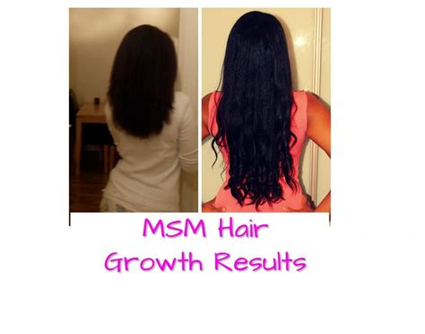 What is MSMHair growth gel supplementbenefitsresultsusespowder ...