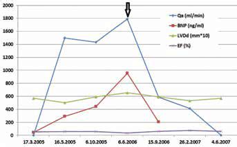 Time course of AVF flow volume and heart characteristics in a single... | Download Scientific ...