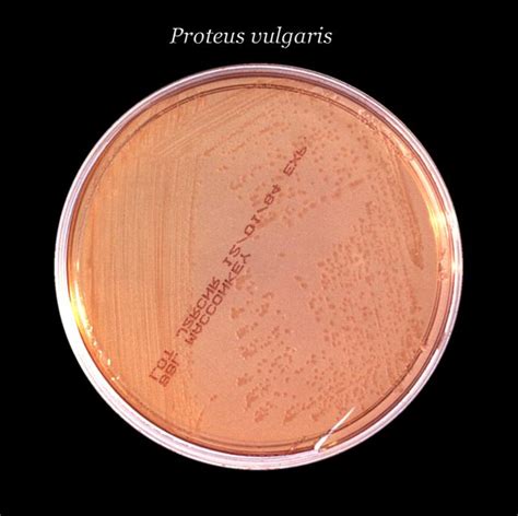 Isolation of Gram Negative Bacteria - WriteWork