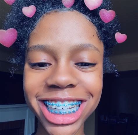 Pin- Iamsunny00 🧚🏽‍♀️ (With images) | Cute braces colors, Cute braces, Braces girls