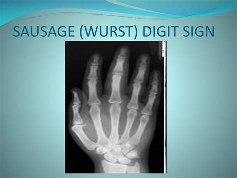 PPT - SIGNS IN RADIOLOGY PowerPoint Presentation, free download - ID:510632