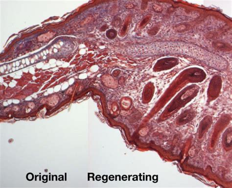 African Spiny Mice Regenerate Lost Tissue