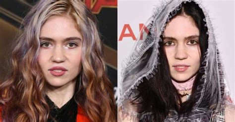 Grimes Posts Selfie for First Time After Surgery and Fans Seem Concerned