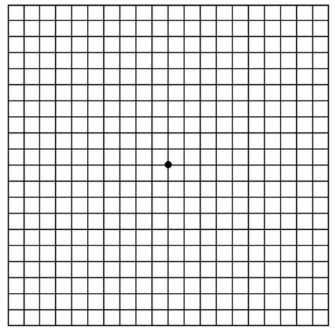 Macular Degeneration Grid Printable