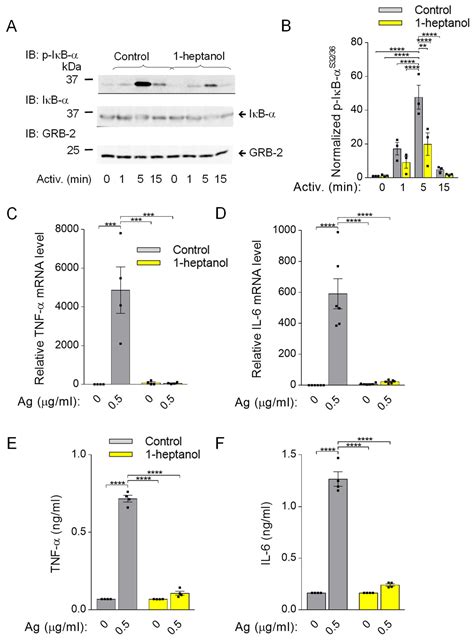 Cells | Free Full-Text | Enhanced Membrane Fluidization and Cholesterol Displacement by 1 ...