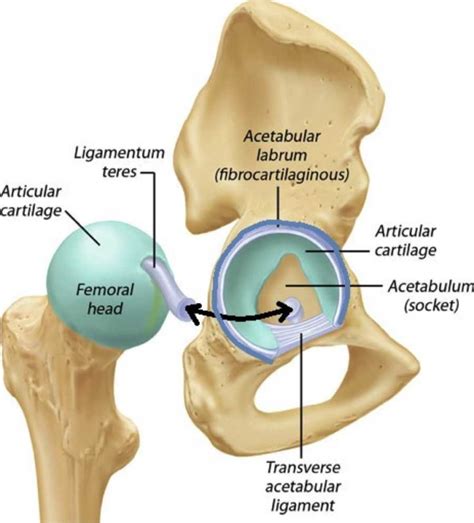 » What is an acetabular labral tear?