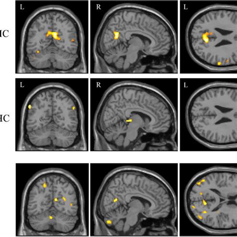 Continuous verbal episodic memory task. The episodic memory task used... | Download Scientific ...