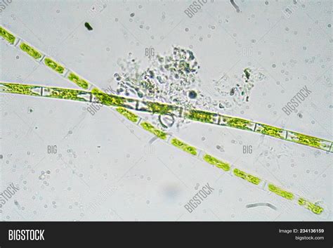 Algae Under Microscope Image & Photo (Free Trial) | Bigstock