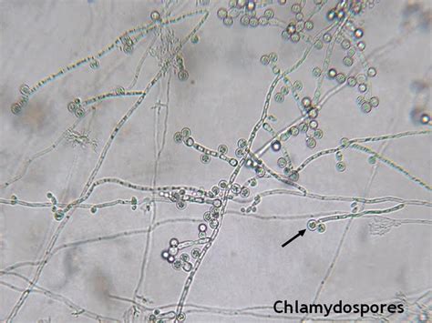 Fun With Microbiology (What's Buggin' You?): Candida albicans