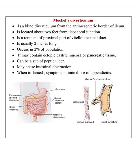 Jejunum and Ileum - Anatomy QA