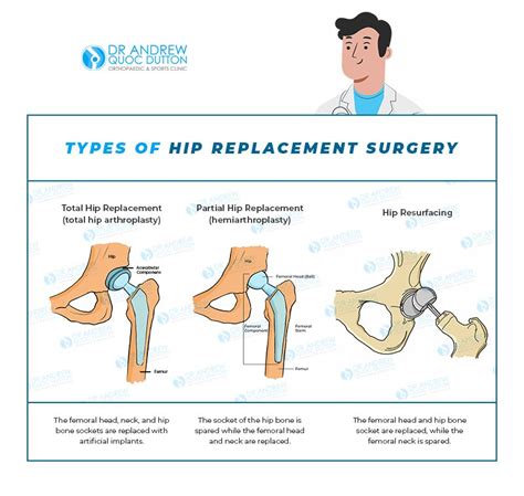 7 Signs That A Hip Replacement Surgery Might Be Needed